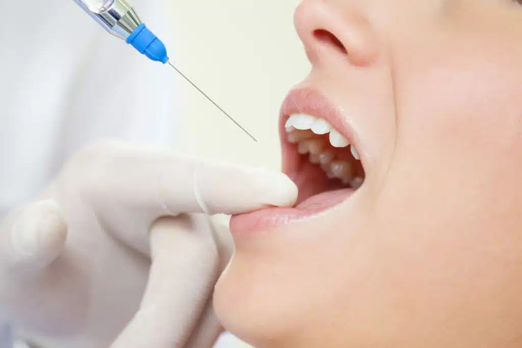 Botox in Dentistry: Unveiling Its Role in Reducing Gum Line Visibility